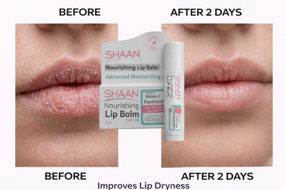 Shaan Lip Balm Rose 5 gm