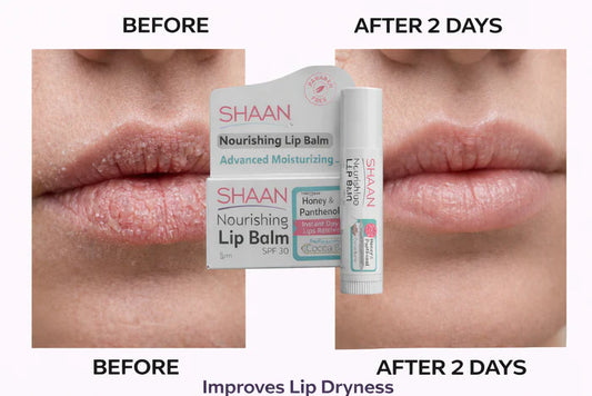 Shaan Lip Balm Strawberry 5 gm